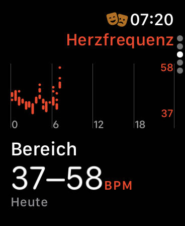 Nur 37er Herzfrequenz nachts